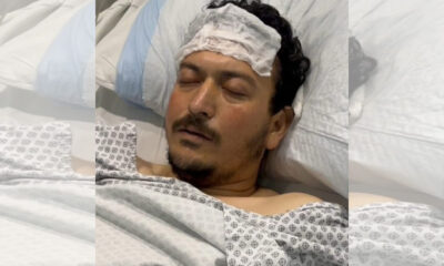 Tarlai Injured Sajid Hussain got martyred