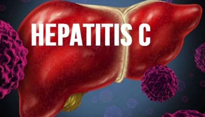 hepatitis