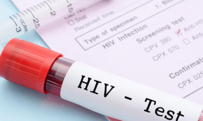 HIV