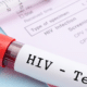 HIV