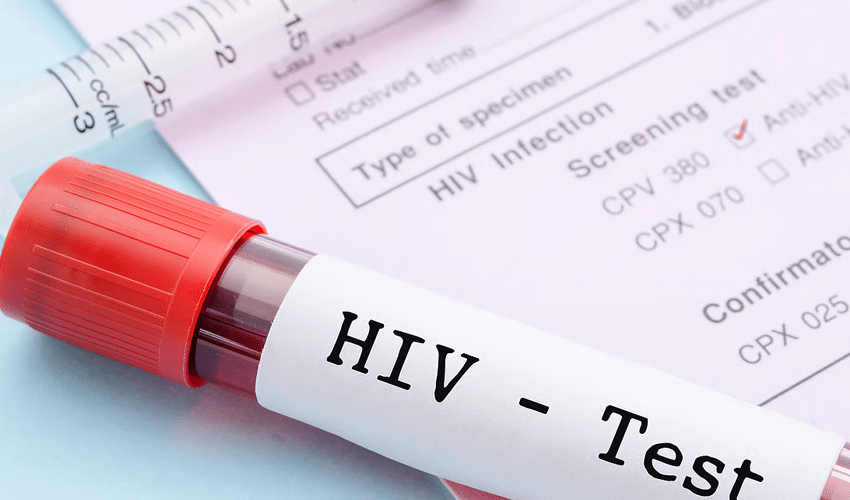 HIV