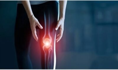 Joint Diseases