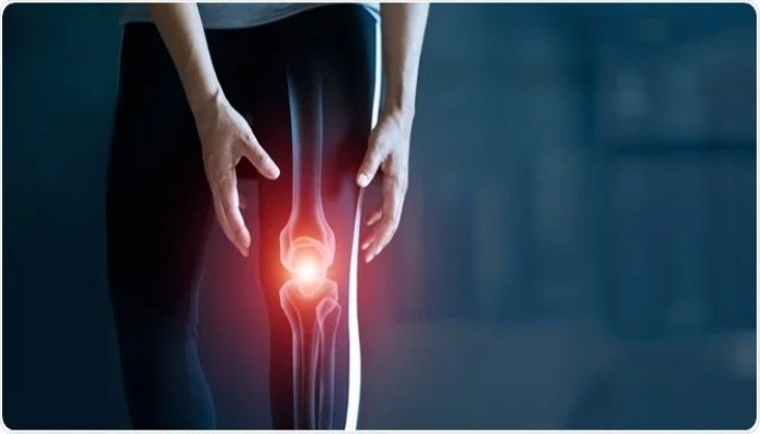 Joint Diseases